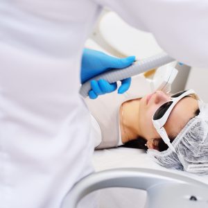 Patient instructions for IPL or RF treatments